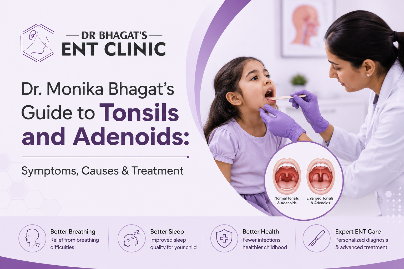 Dr. Monika Bhagat’s Guide to Tonsils and Adenoids: Symptoms, Causes & Treatment