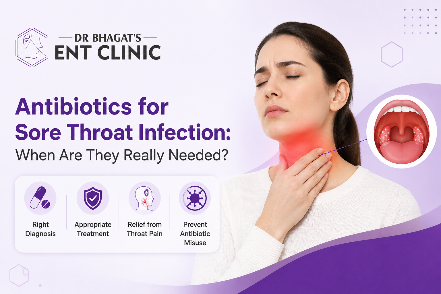 Antibiotics for Sore Throat Infection: When Are They Really Needed?